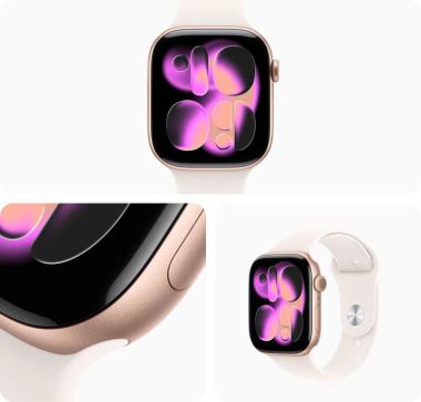 Apple Watch Series 11 Nhôm (GPS)